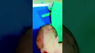 Newborn viral afterbirth/Newborn with enlarge head#trending#viral