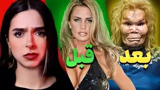❌UNSOLVED❌ بدترین جراحی های زیبایی تاریخ : زندگی‌هایی که تغییر کرد