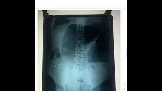 X Rays for Surgery Practical exam for Final Year MBBS exam going students