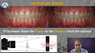 Monday Tip: How to Control the Depth of Field in Dental Photography!