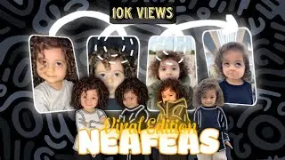 𝐓𝐫𝐞𝐧𝐝𝐢𝐧𝐠 𝐁𝐚𝐛𝐲 𝐍𝐞𝐚𝐟𝐞𝐚𝐬 | Popular video | #love #baby #bigeyes
