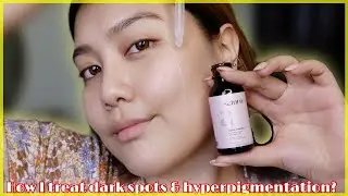 How I deal with dark spots and sun damage🚫 Saturn Alpha Arbutin Serum Review