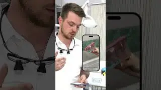 Стоматолог проверяет лайфхак: паста в дорогу #стоматолог #зубы #улыбка