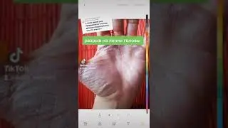 разрыв на линии головы 