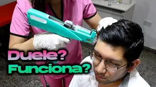 PISTOLA DE MESOTERAPIA ✅: Como funciona?🤔