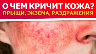90 % проблем с кожей из-за ПСИХОСОМАТИКИ || Как вылечить кожные заболевания?