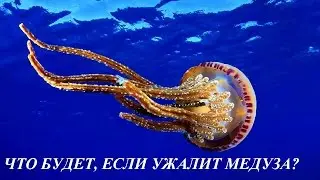 Что будет, если ужалит медуза