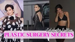 Top 3 Plastic Surgery Star Secrets - Who DID and who DIDN’T