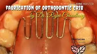 Fabrication of orthodontic tongue crib /habit breaker appliance by Dr. Rajni