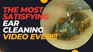 The Most SATISFYING Ear Cleaning EVER!!!