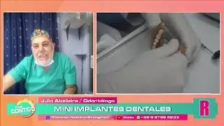 mini implantes adulto mayor 2021