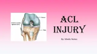 Anterior cruciate ligament injury - causes, symptoms, investigation, treatment, prognosis