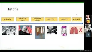 Actualizaciones y manejo de tuberculosis a nivel mundial y en el Ecuador - Dr. Douglas Ramirez