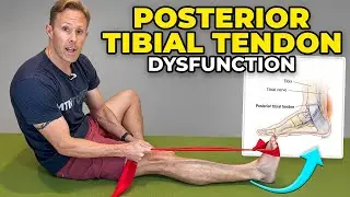 Posterior Tibial Tendon Dysfunction Exercises