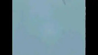 The Hypo-osmotic Swelling Test for Evaluation of Sperm Membrane Integrity (microscope x40)