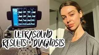 Ultrasound Results, Diagnosis, Health Updates, My Plan