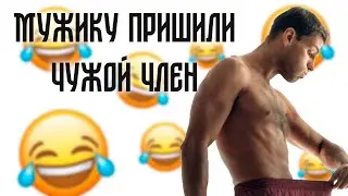 МУЖИКУ пришили чужой ЧЛЭН | СМЕШНЫЕ ПОШЛЫЕ АНЕКДОТЫ