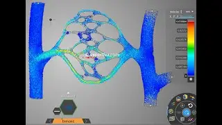 Hemodynamics of Free and Obstructed Blood Flow Through Capillaries - ANSYS Discovery 2021 R1