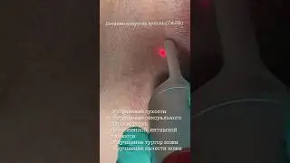 Невыносимый зуд #drvalentinova #женскиесекреты #гинекология #laser #зудкожи #краурозвульвы