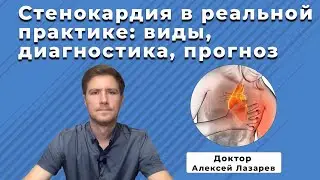 ANGINA IN REAL PRACTICE: TYPES, DIAGNOSIS, PROGNOSIS 