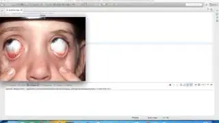 Sub eyelid segmentation - OPENCV 3.1
