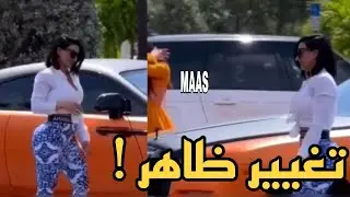 سوسن هارون بعد عملية النحت والشفط