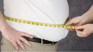 OBESITY DIFFERENTIAL DIAGNOSIS