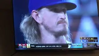 Andrew mc on the pirates mlb team almost got hurt got hit In the hand
