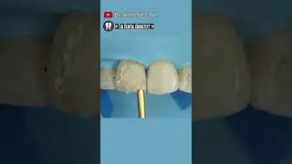Restoring Patient's Confidence 