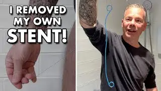 Removing My Own Ureteral Stent After Kidney Stone Surgery: The Painful Truth Revealed!