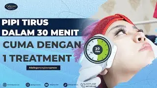 Pipi Tirus Dalam 30 Menit? Cuma dengan 1 Treatment? | Celebrity Lifting
