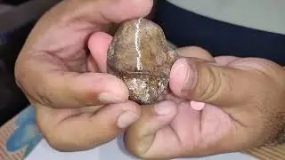 Patella bone part 1 by Dr.A.k.singh