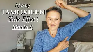 I Discovered an Unpleasant TAMOXIFEN Side Effect in Month 6 | Tamoxifen Vlog | Breast Cancer
