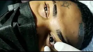 EYEBALL TATTOO BY FREAK UREA