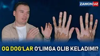 OQ DOG‘LAR O‘LIMGA OLIB KELADIMI?