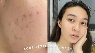 7 Days In Depth Review of Careline Skin Hero Set | Andy Buela (Philippines)