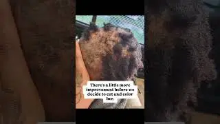 Hair Regrowth Results on My Scarring Alopecia Customer - Lichen Planopilaris/CCCA #hairloss #houston