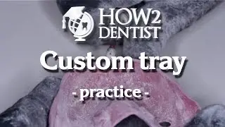 How to make a custom tray / How to Dentist