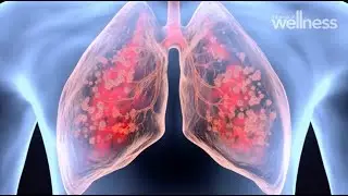 The harms of vaping: Why the main consumers are young children