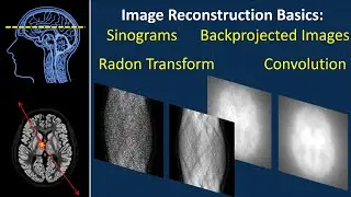 Image reconstruction: sinograms, backprojected images, convolution, Radon & x-ray transform