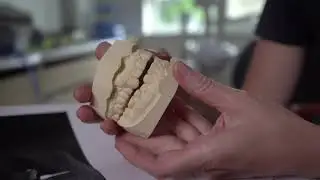 Ортогнатическая хирургия. Исправление прикуса. Ортодонт