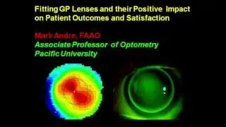 Fitting GP Lenses Part 1 - Mark Andre