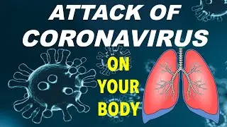 How Coronavirus attacks Body? How COVID-19 affects Body?