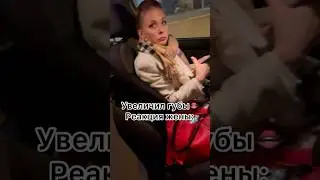 Дожили! Мужик накачал губы!