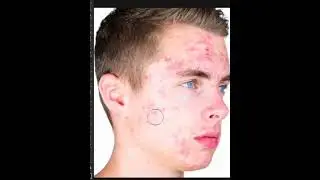 Skin Retouching in Photoshop