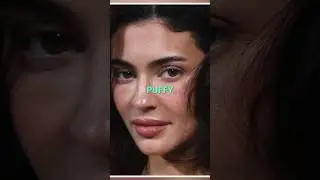 Kylie Jenner's Controversial cosmetic procedures: What's behind the puffiness? #kyliejenner #shorts