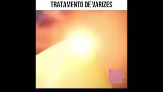 Video produto tratamento contra varizes