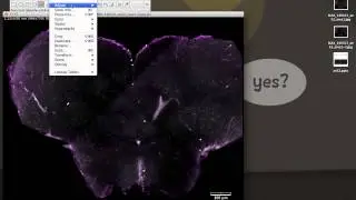 Calculate Area in ImageJ