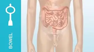 Bowel incontinence and chronic constipation