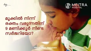 മൂക്കിൽ നിന്ന് രക്തം വരുന്നതിന് 9 മണിക്കൂർ നീണ്ട സർജറിയോ?